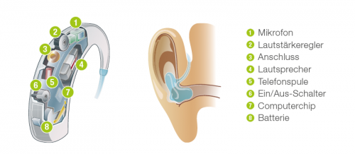 hoergeraete-funktionsweise